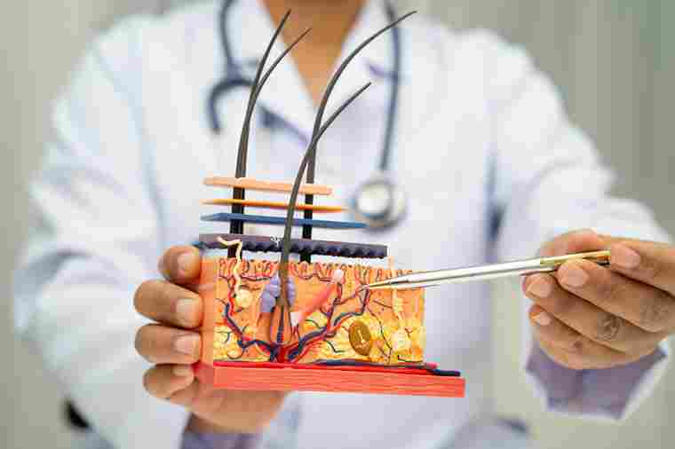 Arzt zeigt mit Kugelschreiber auf Modell von Haarwurzel